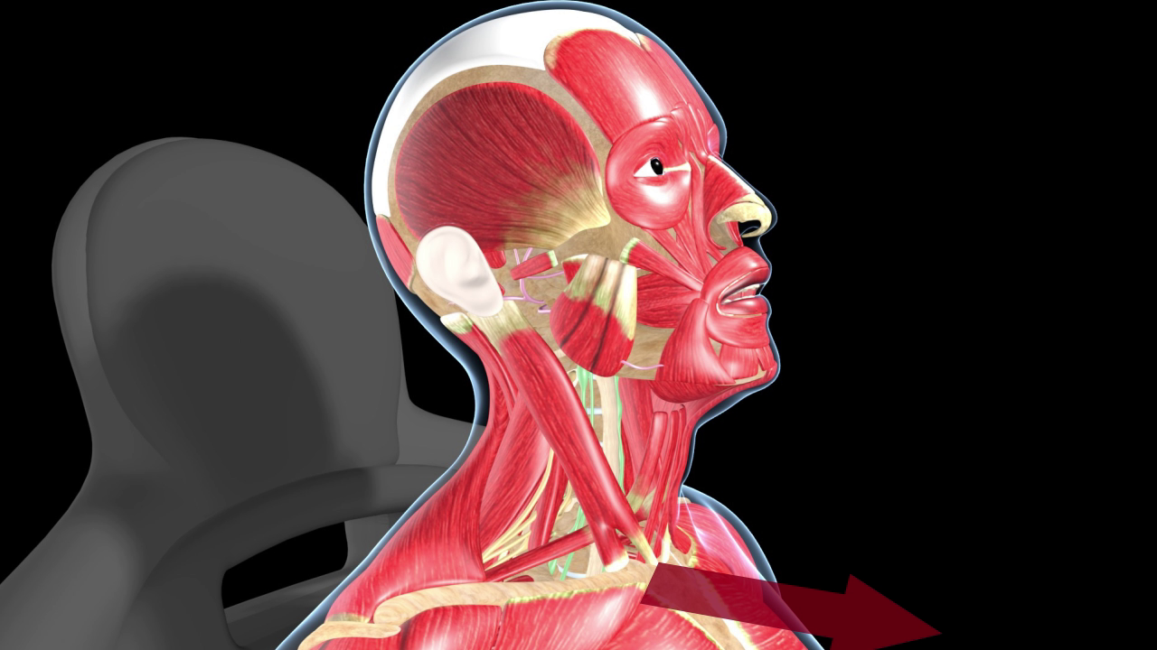 Advanced Personal Injury module preview — Muscle Damage in a Rear-End Collision